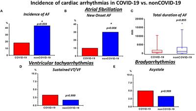 Higher Incidence of Stroke in Severe COVID-19 Is Not Associated With a Higher Burden of Arrhythmias: Comparison With Other Types of Severe Pneumonia